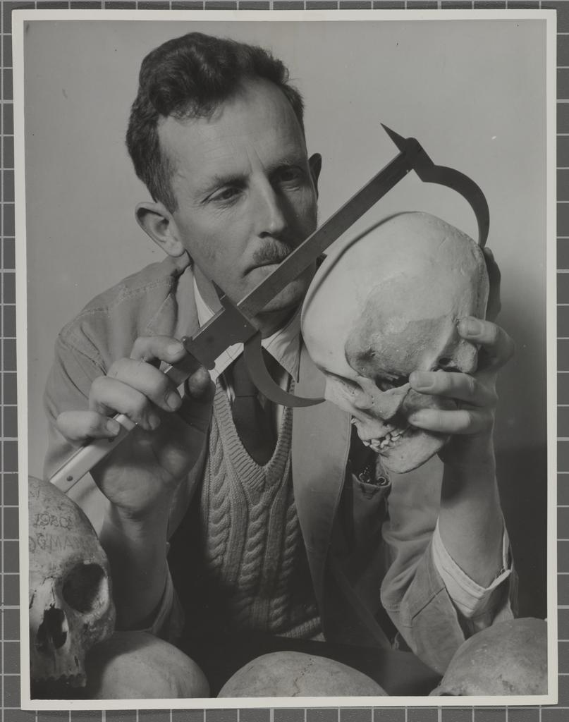 Measuring a skull in the Department of Anatomy, Otago  Medical School