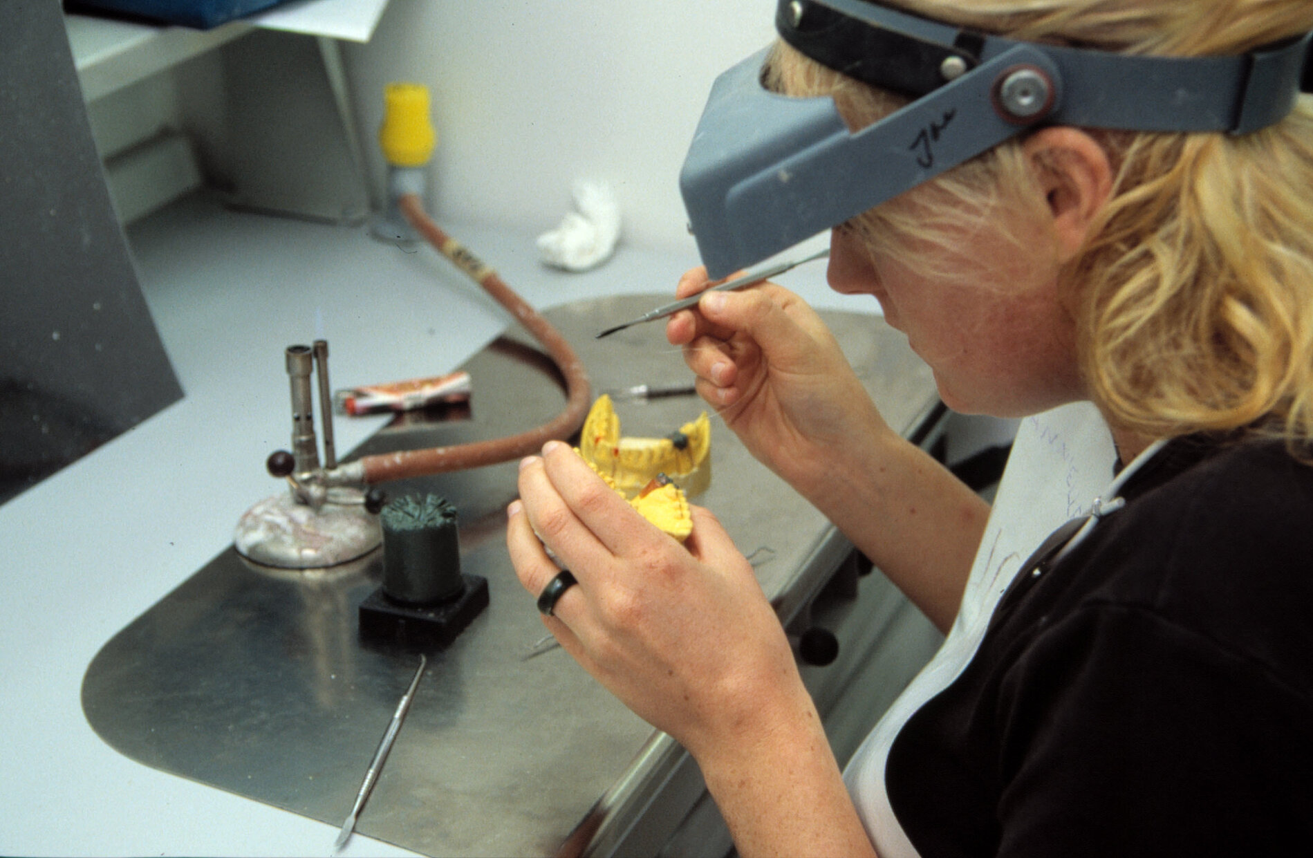 Dental technology