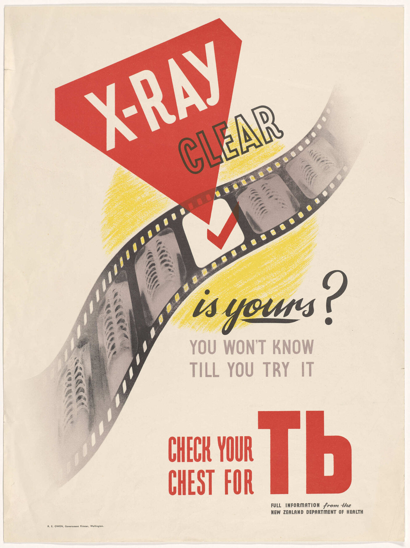 "X-ray Clear is yours? You Won't Know Till You Try It Check Your Chest For Tb"